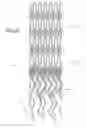 Fig. 05 - Ostium support for treating vascular bifurcations