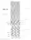 Fig. 06 - Ostium support for treating vascular bifurcations