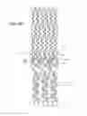 Fig. 07 - Ostium support for treating vascular bifurcations