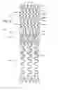 Fig. 11 - Ostium support for treating vascular bifurcations