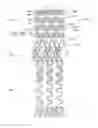 Fig. 13 - Ostium support for treating vascular bifurcations