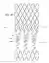 Fig. 17 - Ostium support for treating vascular bifurcations