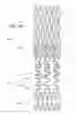 Fig. 18 - Ostium support for treating vascular bifurcations