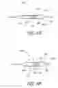 Fig. 23 - Ostium support for treating vascular bifurcations
