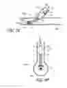 Fig. 24 - Ostium support for treating vascular bifurcations