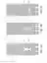 Fig. 29 - Ostium support for treating vascular bifurcations