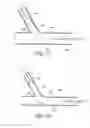 Fig. 35 - Ostium support for treating vascular bifurcations