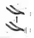 Fig. 14 - ENDOVASCULAR PLATFORMS FOR THE DIFFERENTIAL TARGETING OF MOLECULES TO VESSEL WALL AND VESSEL LUMEN