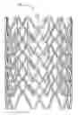 Fig. 01 - FATIGUE-RESISTANT STENT