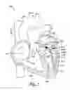 Fig. 02 - TRANSLUMENAL APPARATUS, SYSTEM, AND METHOD
