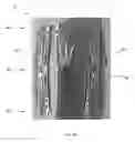 Fig. 05 - APPARATUS AND METHOD FOR REPLACING A DISEASED CARDIAC VALVE