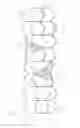 Fig. 13 - APPARATUS AND METHOD FOR REPLACING A DISEASED CARDIAC VALVE