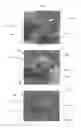 Fig. 22 - APPARATUS AND METHOD FOR REPLACING A DISEASED CARDIAC VALVE