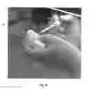 Fig. 23 - APPARATUS AND METHOD FOR REPLACING A DISEASED CARDIAC VALVE