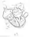 Fig. 26 - APPARATUS AND METHOD FOR REPLACING A DISEASED CARDIAC VALVE