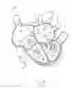 Fig. 27 - APPARATUS AND METHOD FOR REPLACING A DISEASED CARDIAC VALVE