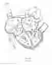 Fig. 28 - APPARATUS AND METHOD FOR REPLACING A DISEASED CARDIAC VALVE