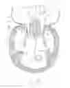 Fig. 30 - APPARATUS AND METHOD FOR REPLACING A DISEASED CARDIAC VALVE