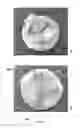 Fig. 40 - APPARATUS AND METHOD FOR REPLACING A DISEASED CARDIAC VALVE