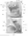 Fig. 41 - APPARATUS AND METHOD FOR REPLACING A DISEASED CARDIAC VALVE