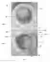 Fig. 42 - APPARATUS AND METHOD FOR REPLACING A DISEASED CARDIAC VALVE