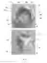 Fig. 43 - APPARATUS AND METHOD FOR REPLACING A DISEASED CARDIAC VALVE