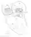 Fig. 51 - APPARATUS AND METHOD FOR REPLACING A DISEASED CARDIAC VALVE