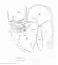 Fig. 52 - APPARATUS AND METHOD FOR REPLACING A DISEASED CARDIAC VALVE
