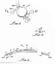 Fig. 04 - Ophthalmic sizing devices and methods