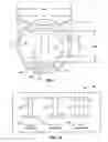 Fig. 05 - Ophthalmic sizing devices and methods