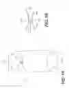 Fig. 02 - Device and method for treatment of incision or hernia