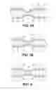 Fig. 06 - Device and method for treatment of incision or hernia
