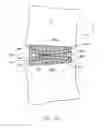 Fig. 09 - Anatomic spinal implant having anatomic bearing surfaces