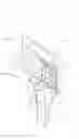 Fig. 01 - Method of implanting a unicondylar knee prosthesis