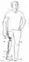 Fig. 08 - Replaceable fairing for prosthetic limb or brace