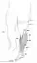 Fig. 10 - Replaceable fairing for prosthetic limb or brace