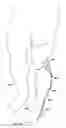 Fig. 11 - Replaceable fairing for prosthetic limb or brace