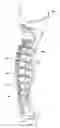 Fig. 12 - Replaceable fairing for prosthetic limb or brace