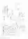 Fig. 14 - Dialysis system including downloaded prescription entry