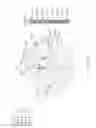 Fig. 28 - CLINICAL APPLICATIONS OF NEUROPSYCHOLOGICAL PATTERN ANALYSIS AND MODELING