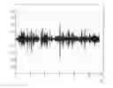 Fig. 01 - Method for wind noise reduction
