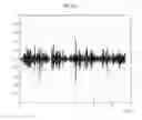 Fig. 09 - Method for wind noise reduction