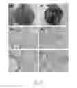 Fig. 06 - Method for manufacturing animal model for researching pulmonary tumor and use thereof