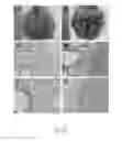 Fig. 07 - Method for manufacturing animal model for researching pulmonary tumor and use thereof