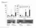Fig. 11 - Method of identifying a compound for preventing and/or treating an autoimmune disease