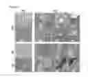 Fig. 14 - Method of identifying a compound for preventing and/or treating an autoimmune disease