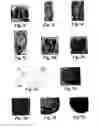 Fig. 12 - COMPOSITIONS AND METHODS FOR MODULATION OF PLANT CELL DIVISION