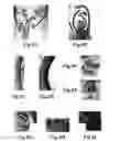 Fig. 13 - COMPOSITIONS AND METHODS FOR MODULATION OF PLANT CELL DIVISION