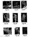 Fig. 14 - COMPOSITIONS AND METHODS FOR MODULATION OF PLANT CELL DIVISION