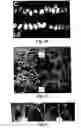 Fig. 15 - COMPOSITIONS AND METHODS FOR MODULATION OF PLANT CELL DIVISION